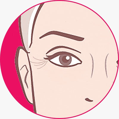 Under-Eye Bags