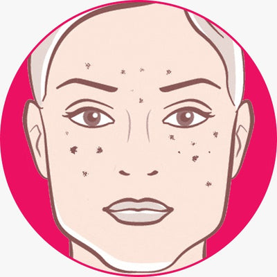 DRY SKIN